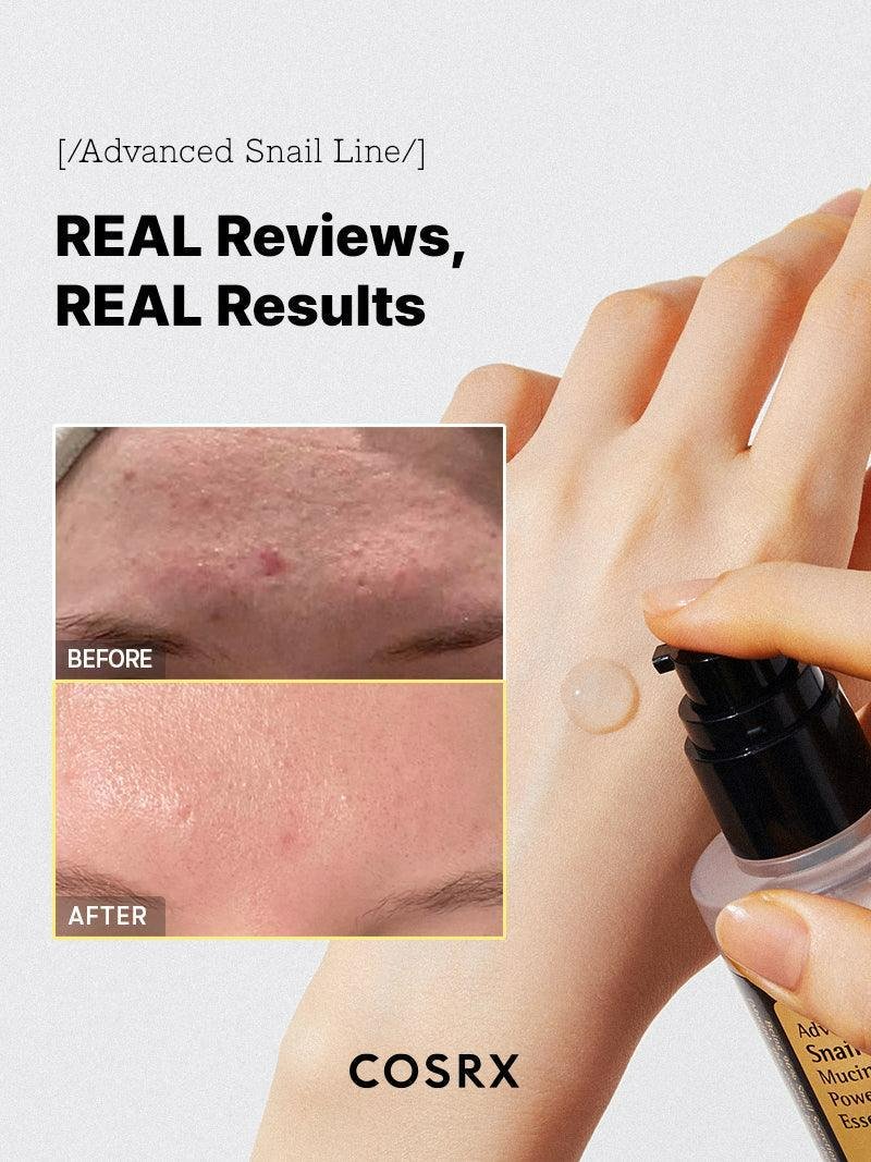 COSRX Advanced Snail96 Mucin Power Essence 30 ml.