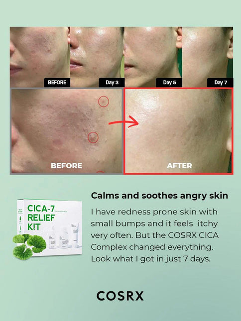COSRX CICA-7 Relief Kit