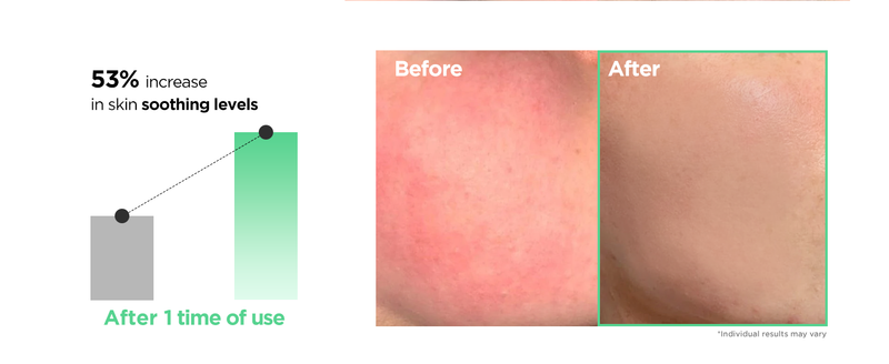 Easydew Dw Egf Multy Vita Serum E