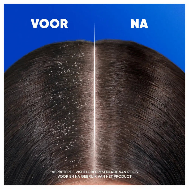 Head & Shoulders Intense Hydration Shampoo