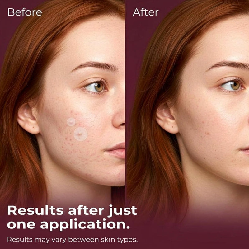 Patches and Pads Pimple Patches Spotted Day