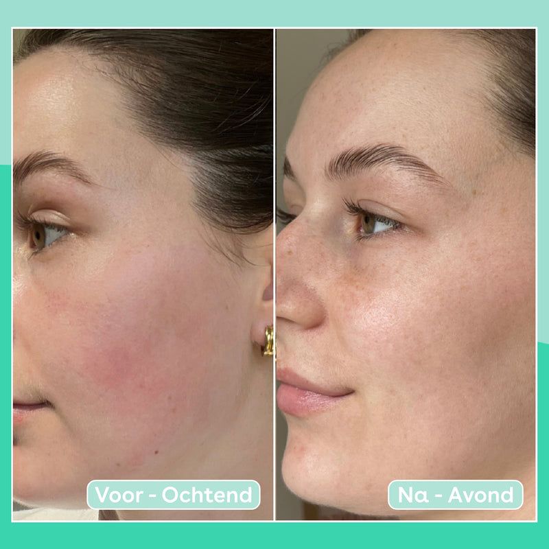 Q+A Cica Overnight Mask