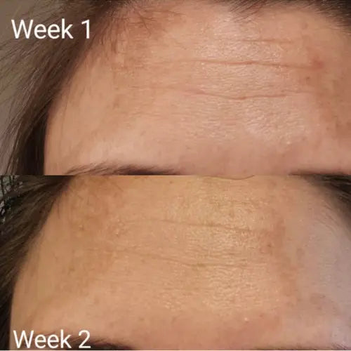 Bbody Tripeptide Collagen