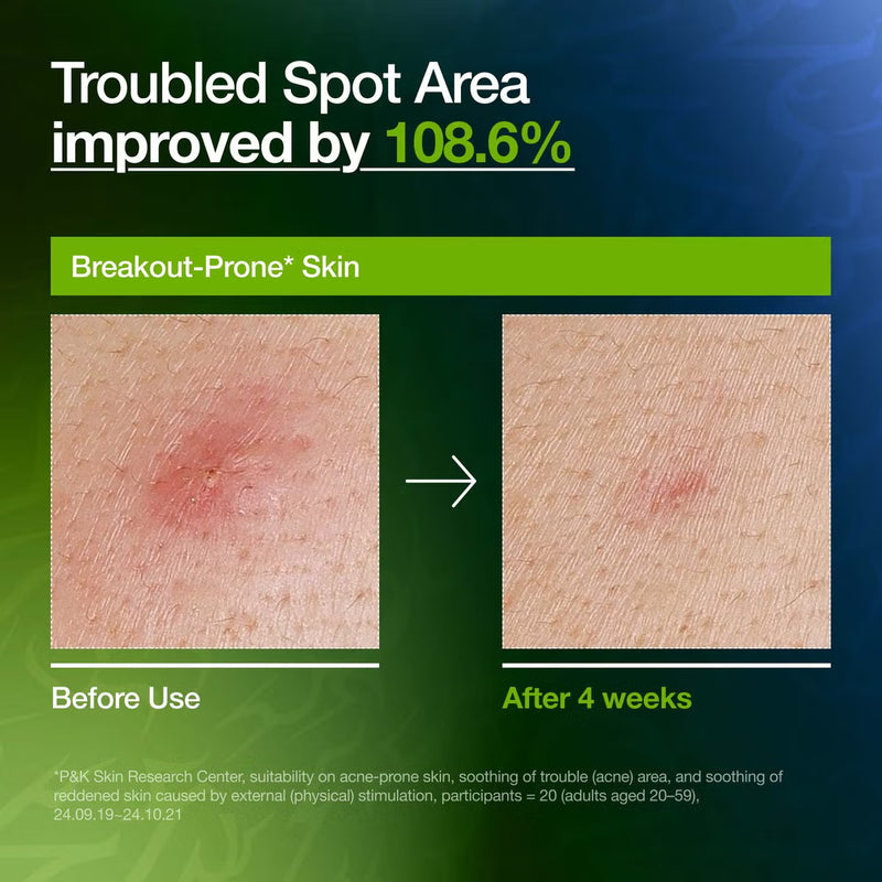 Anua K-Pop Demon Hunters Azelaic Acid 10 Hyaluron Redness Soothing Serum 50 ml.