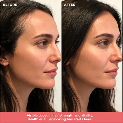 ByRokko Hair Gummies