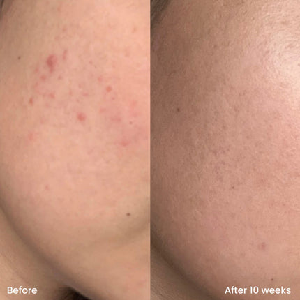 Clay And Glow Triple AHA Cleanser