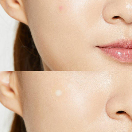 COSRX Acne Pimple Master Patch Original Fit