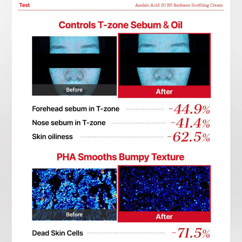 COSRX Azelaic Acid 20 B5 Redness Soothing Cream
