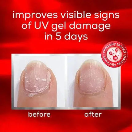 Essie To The Rescue Nail Treatment