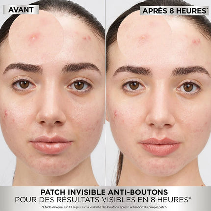 Garnier PureActive Pimple Patch