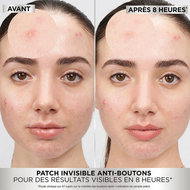 Garnier PureActive Pimple Patch