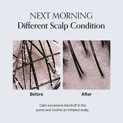 GROWUS Damage Therapy Scalp Scaling Ampoule