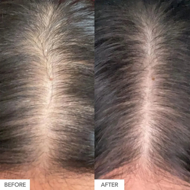 Hairtamin Advanced Formula Vitamins