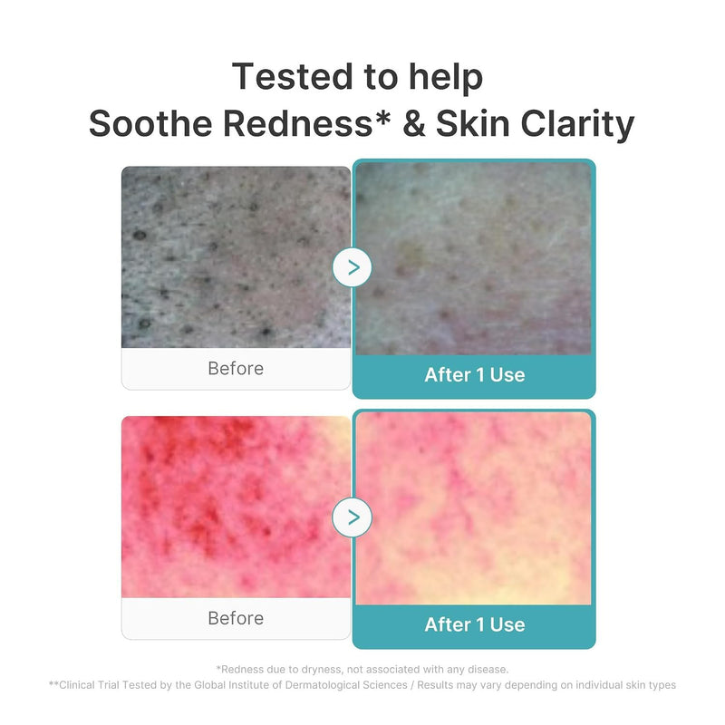 Medicube Azelaic Acid Capsule Cleansing Foam, een reinigingsschuim voor de vette en onrustige huid