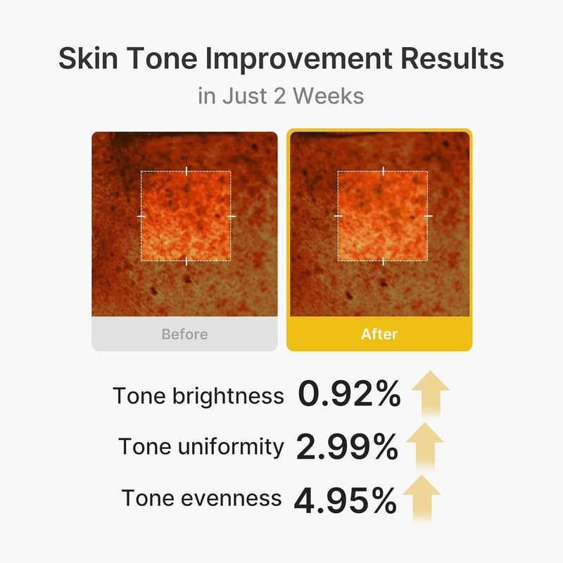 Medicube Kojic Acid Turmeric Vita Capsule Cream, gezichtscrème voor egale en stralende huid