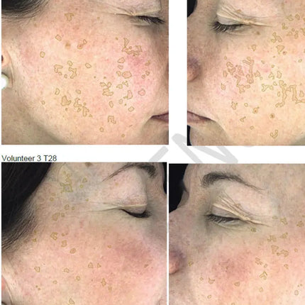 NERDS Hyperpigmentation Serum - 2% Alpha Arbutin + 1% Kojic Acid