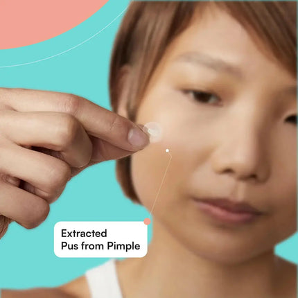 Skin Choice Breakout Patch Classic Pack Of 30