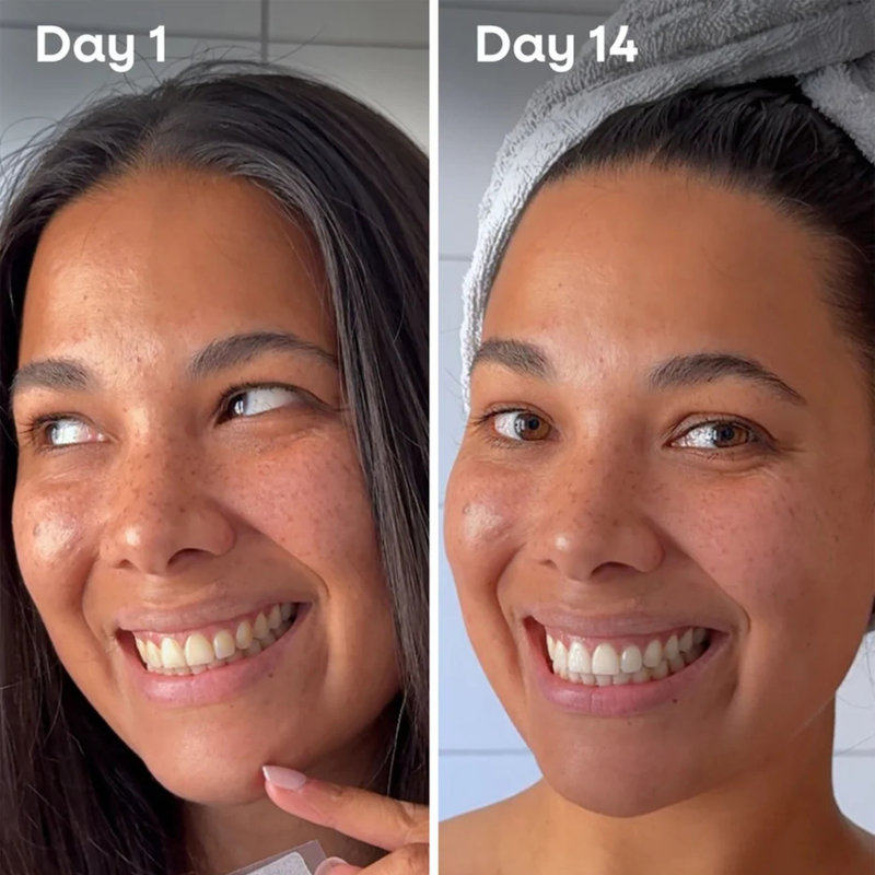 The Humble Co. Whitening Strips Aloe Vera
