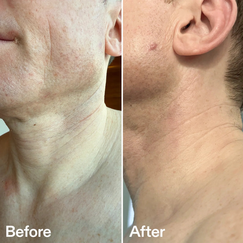 The Inkey List Bio Active Ceramide Neck Stick
