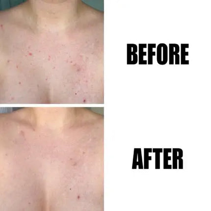 The Inkey List Glycolic Acid Exfoliating Body Stick