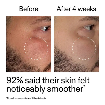 The Inkey List Starter Retinol Serum
