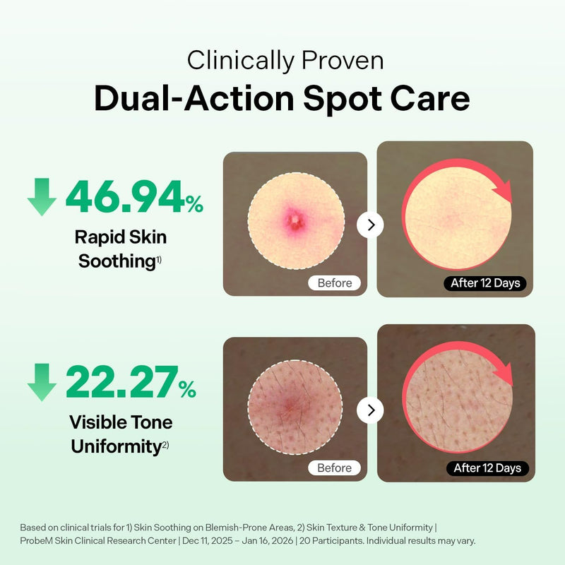 Torriden Balanceful Azelaic Acid Micropoint Spot Patch