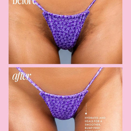 Truly Beauty Cooka Ingrown Concentrate