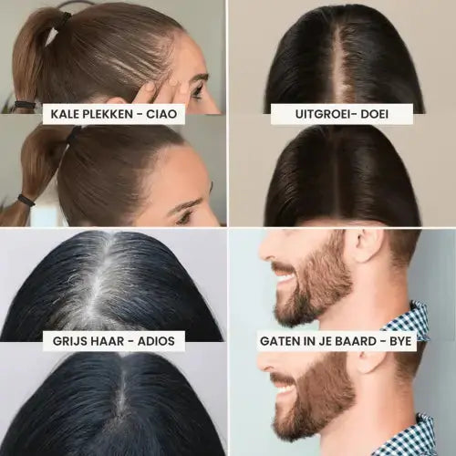 Imperio Uitgroei Poeder Donkergrijs